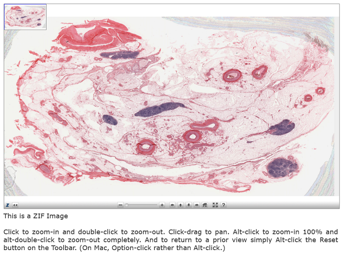 Example Histology image and associated instructions for zooming in when viewing an image